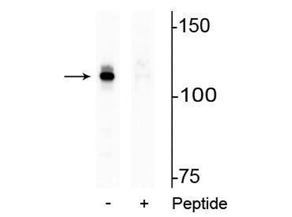 Western blot of Anti-Androgen Receptor pS94 antobdy